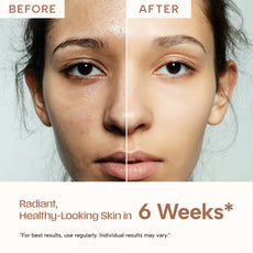 Trutatva Tru Radiance Face Serum