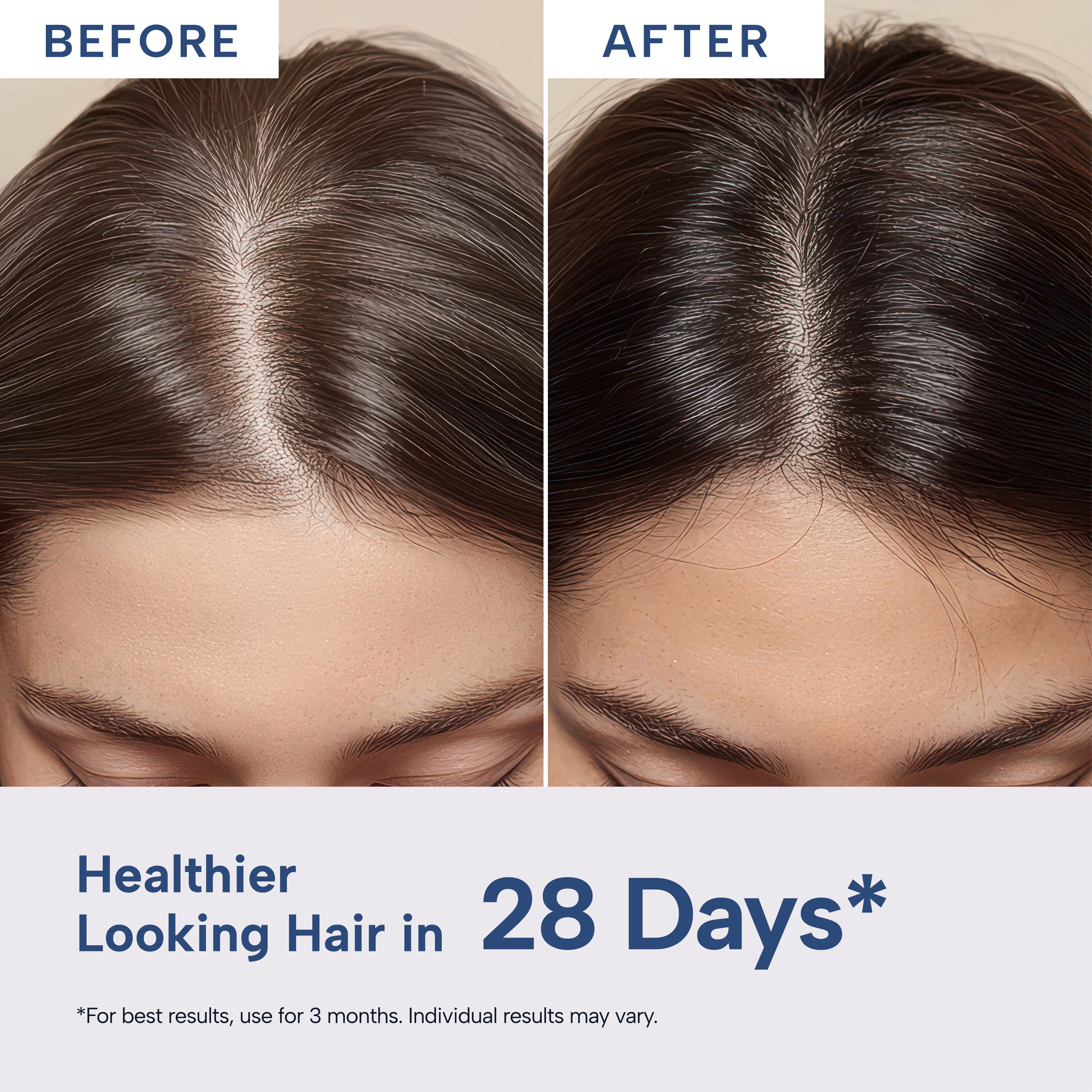 Trutatva Advance Plus Hair Serum